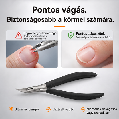 ✂️Precíziós benőtt körömvágó készlet